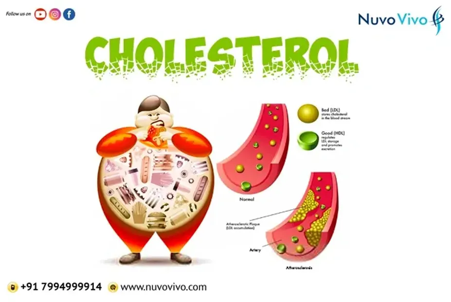 Read more about the article Understanding your cholesterol & lipid profile