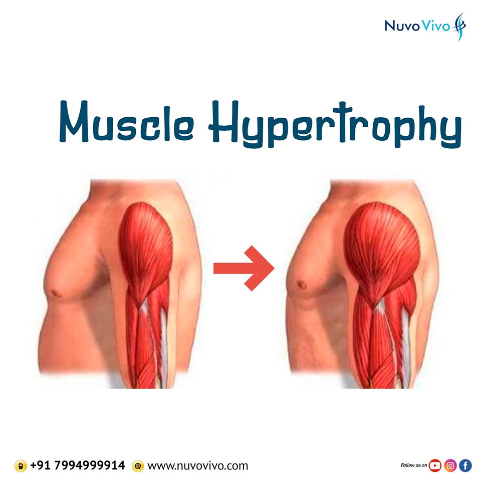 Muscle-Hypertrophy