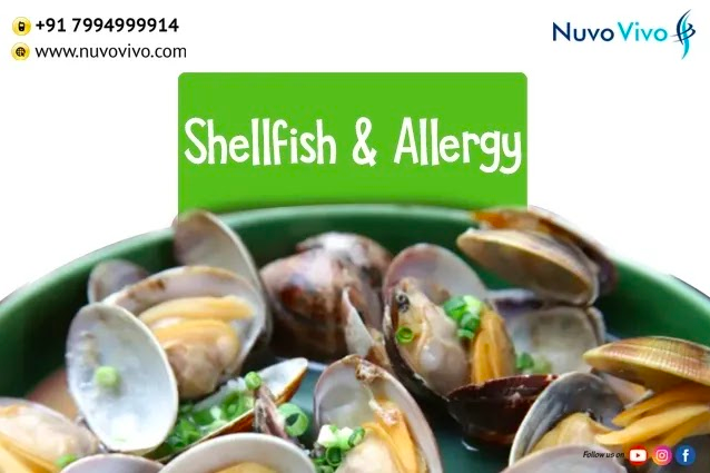 Read more about the article Shell Fish & Allergy