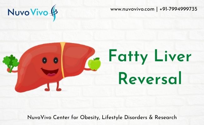 Fatty-Liver-Reversal-Diet