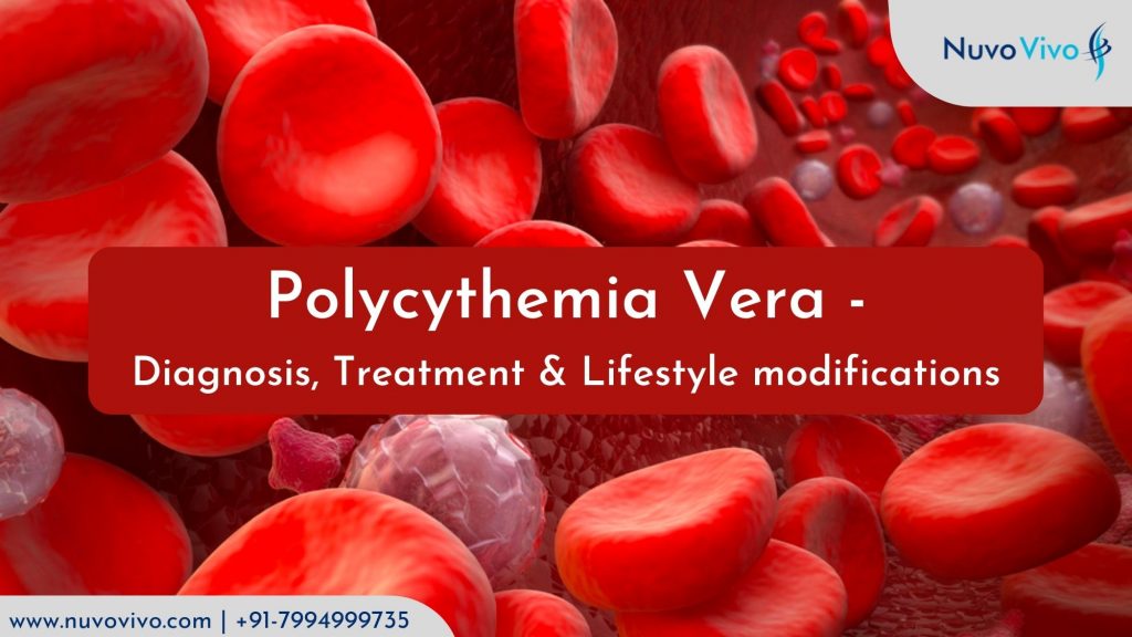 Polycythemia-Vera-Diagnosis-Treatment-Lifestyle-modifications