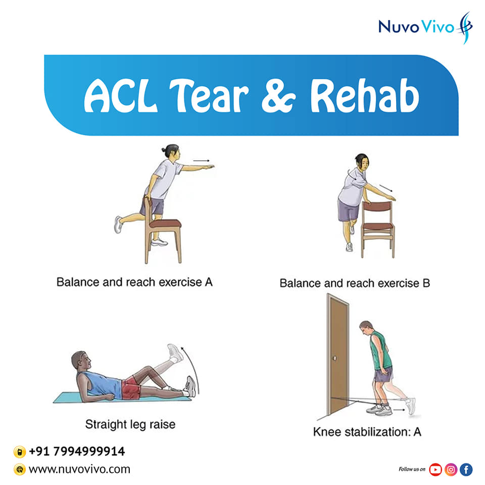 ACL Tear & Rehab
