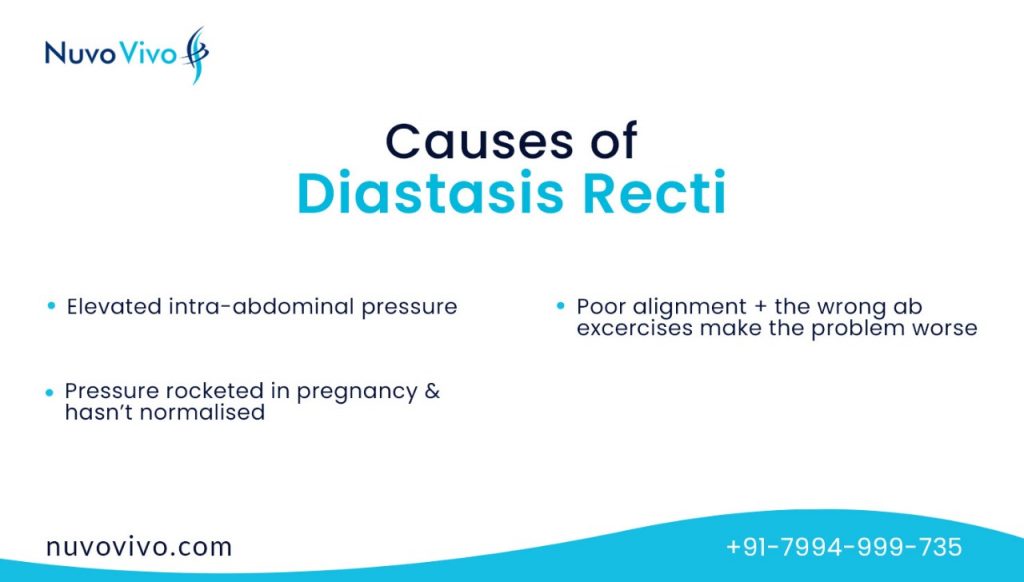 Causes of Diastasis Recti
