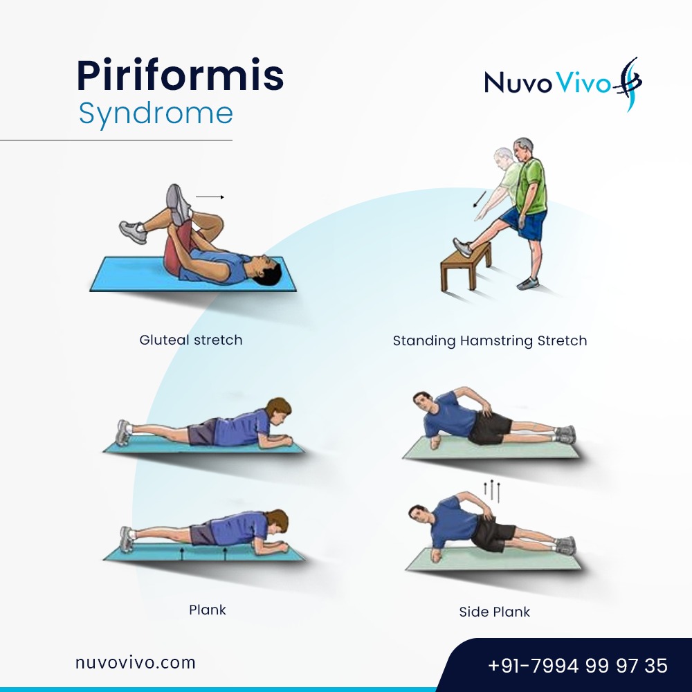 Piriformis-Syndrome-Exercises 1