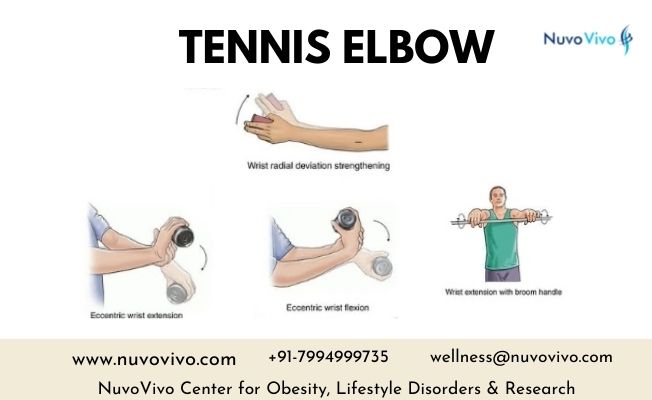 Tennis Elbow Exercises