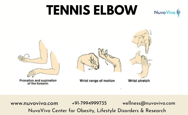 Tennis Elbow Rehab