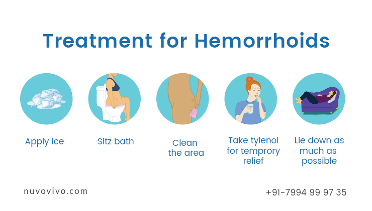 Treatment for Hemorrhoids